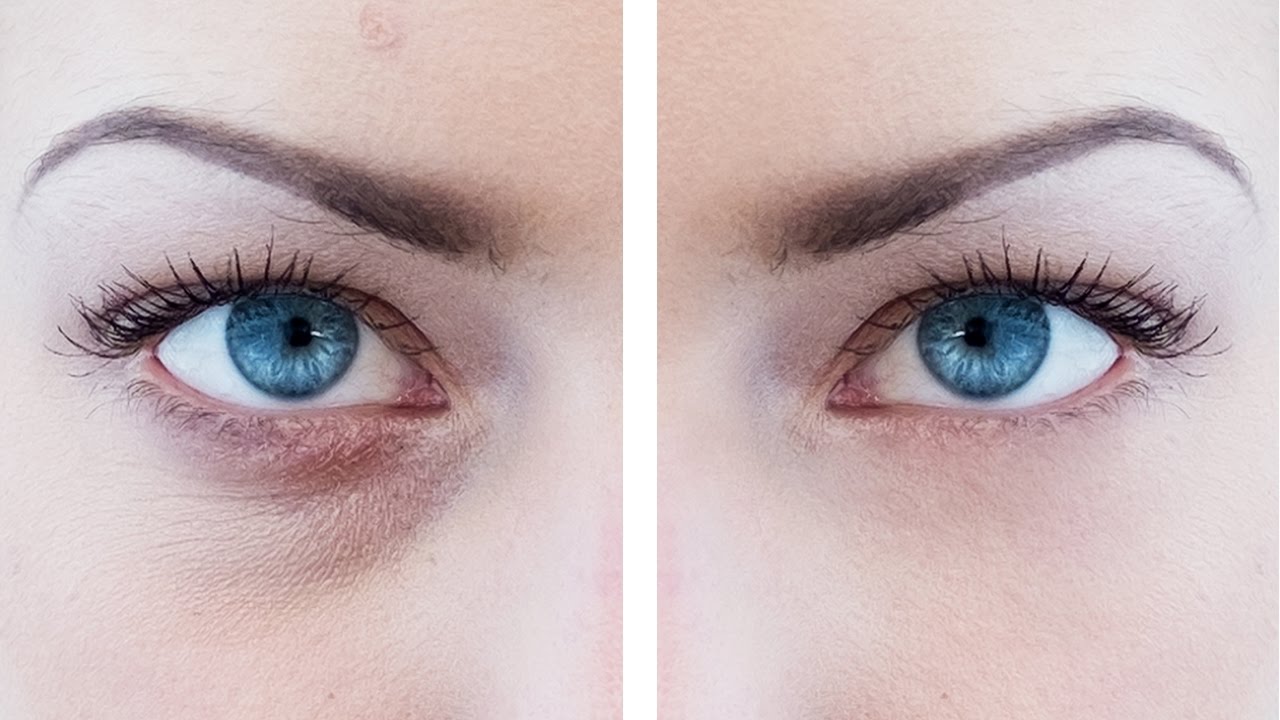 How to Remove Bags under Eyes Photoshop